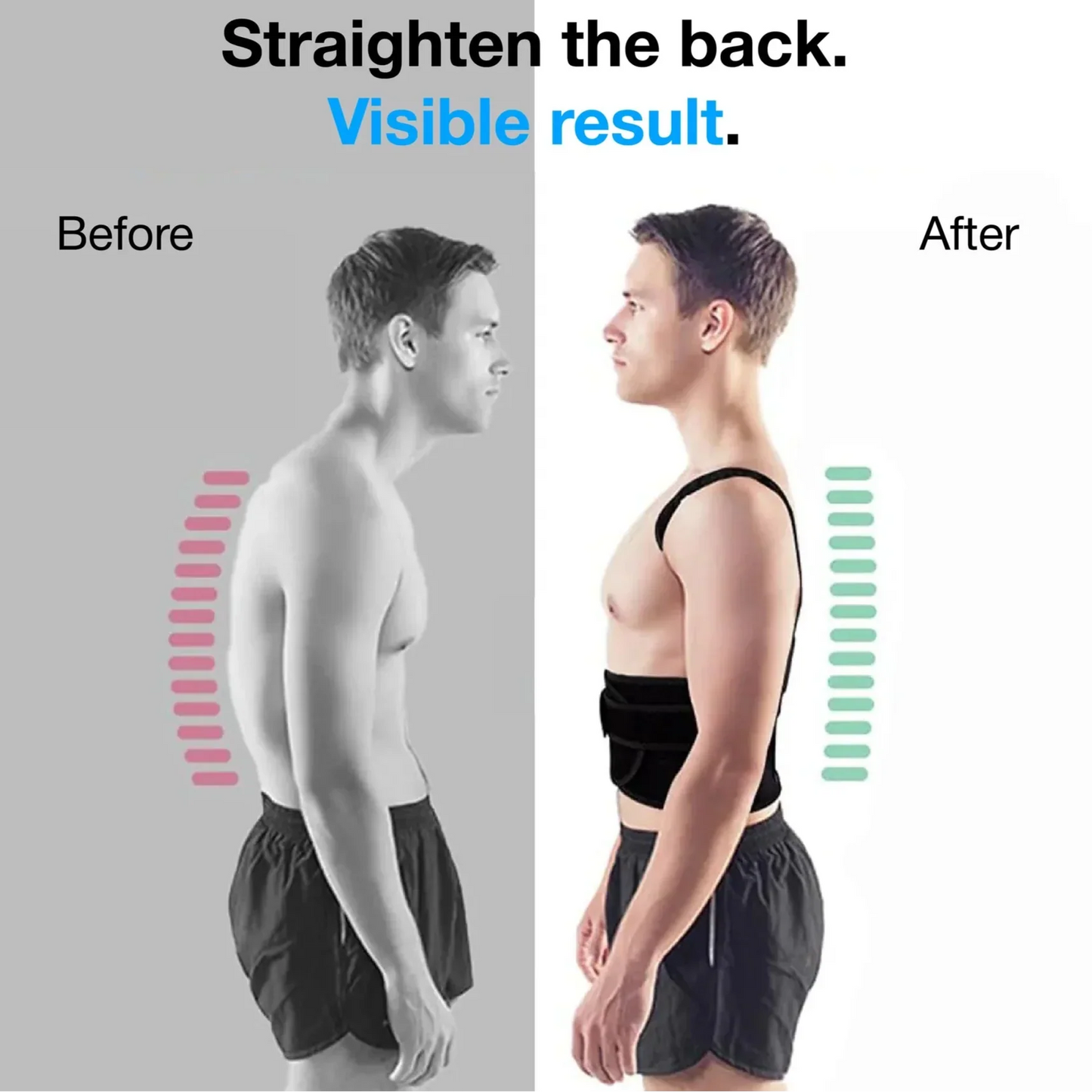 PrimePickz PostureFlex™ Pro – Advanced Back & Shoulder Posture Corrector for Pain Relief