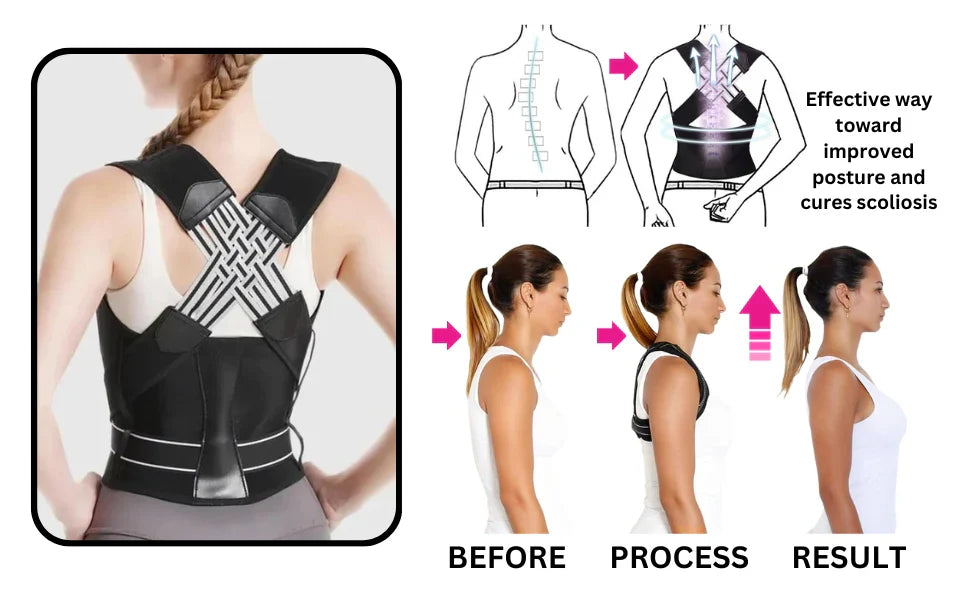 PrimePickz PostureFlex™ Pro – Advanced Back & Shoulder Posture Corrector for Pain Relief